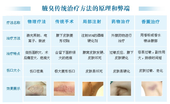 腋臭最新,腋臭最新研究与治疗进展